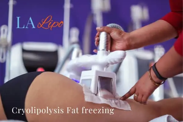 women getting fat freezing Whitley Sands