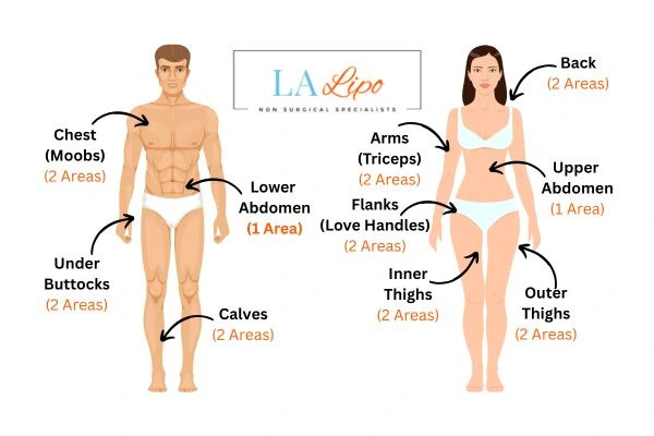 LA LIPO Cryolipolysis Areas Whitley Sands