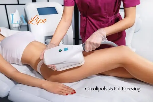 Woman receiving coolsculpting Whitley Sands treatment on her thighs