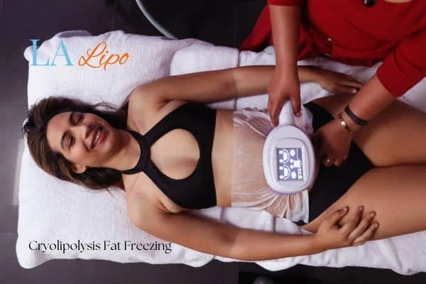 woman getting cryolipolysis Whitley Sands