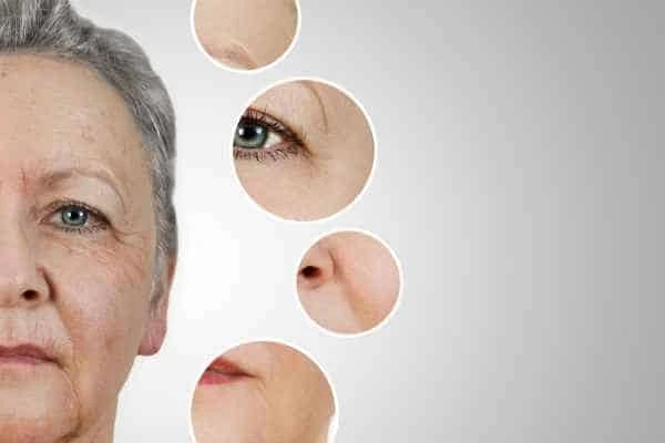 HIFU Facelift Whitley Sands from LA LIPO