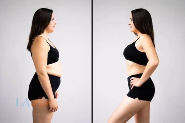 Picture of womans before and after using LA-EMS body sculpting to improve her core strength Whitley Sands