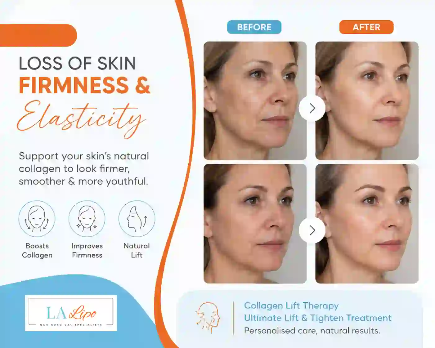 Sign #7: Loss of Skin Firmness and Elasticity Whitley Sands